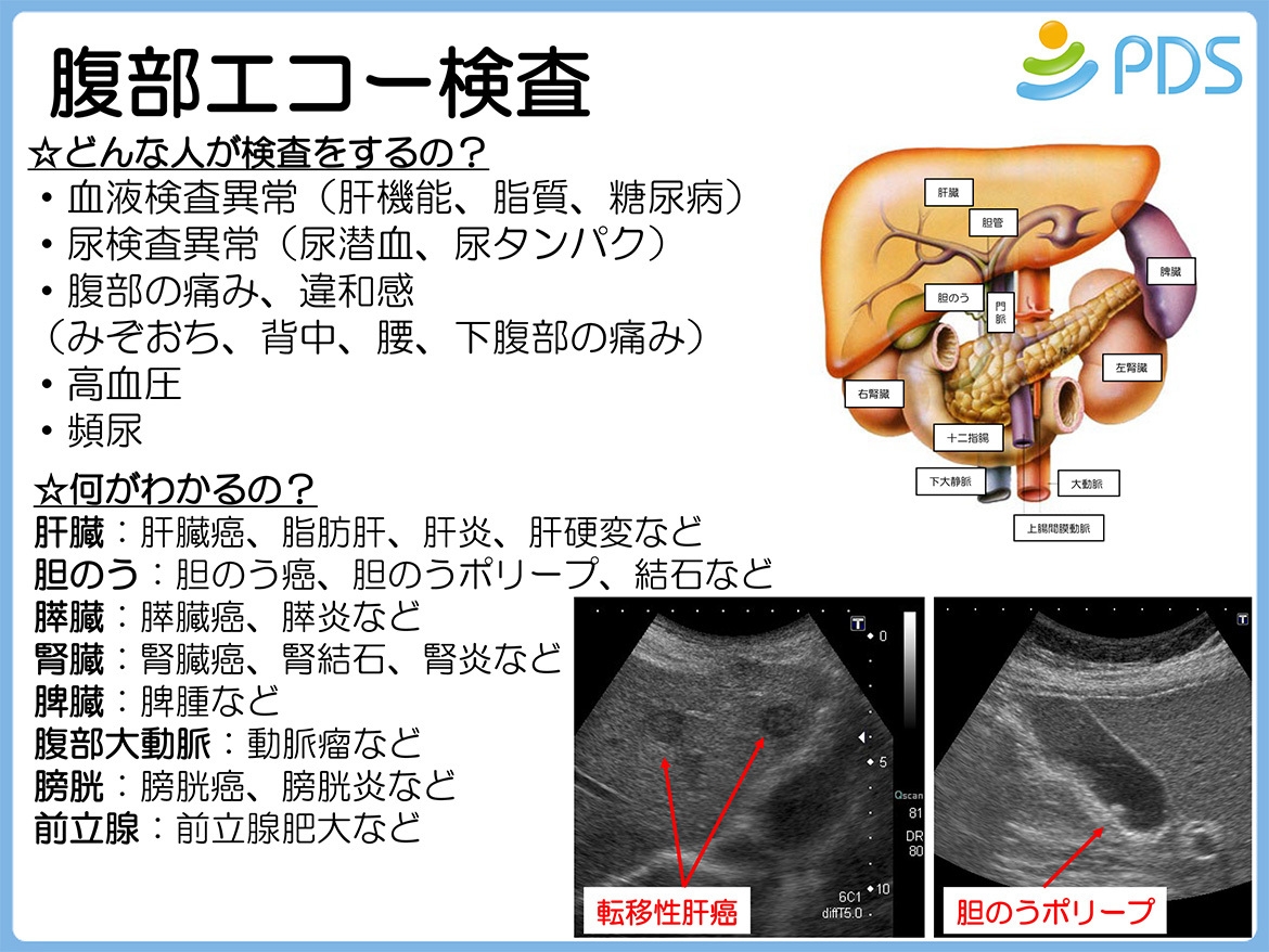 腹部エコー検査