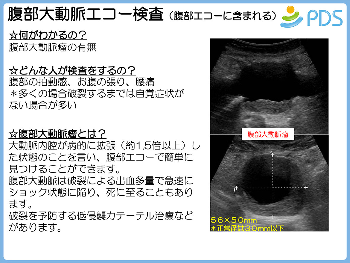 腹部大動脈エコー検査