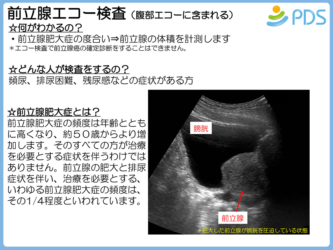 前立腺エコー検査