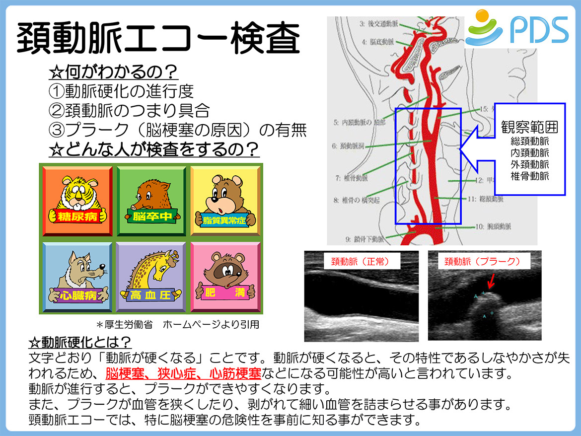 頚動脈エコー検査