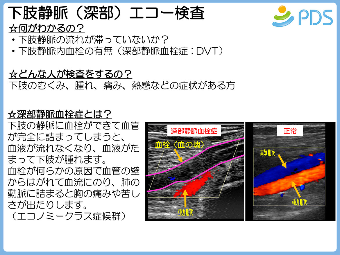 下肢静脈（深部）エコー検査